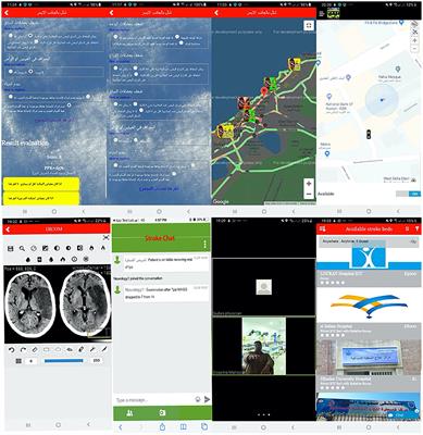 Using ESN-Smartphone Application to Maximize AIS Reperfusion Therapy in Alexandria Stroke Network: A Stroke Chain of Survival Organizational Model